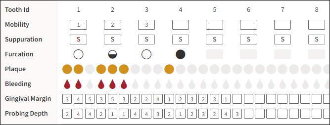 Perio exam conditions section showing multiple conditions, gingival margin, and probing depth.